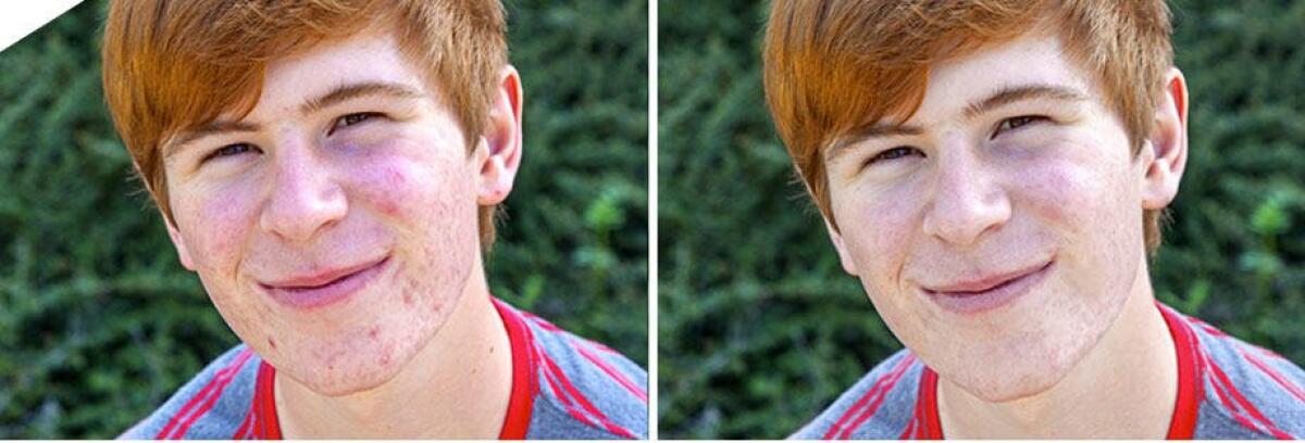 Snapheal Pro Gratis con Licenza: Rimuovere oggetti, migliorare, applicare Watermark e molto altro alle vostre Foto [MAC App] - 