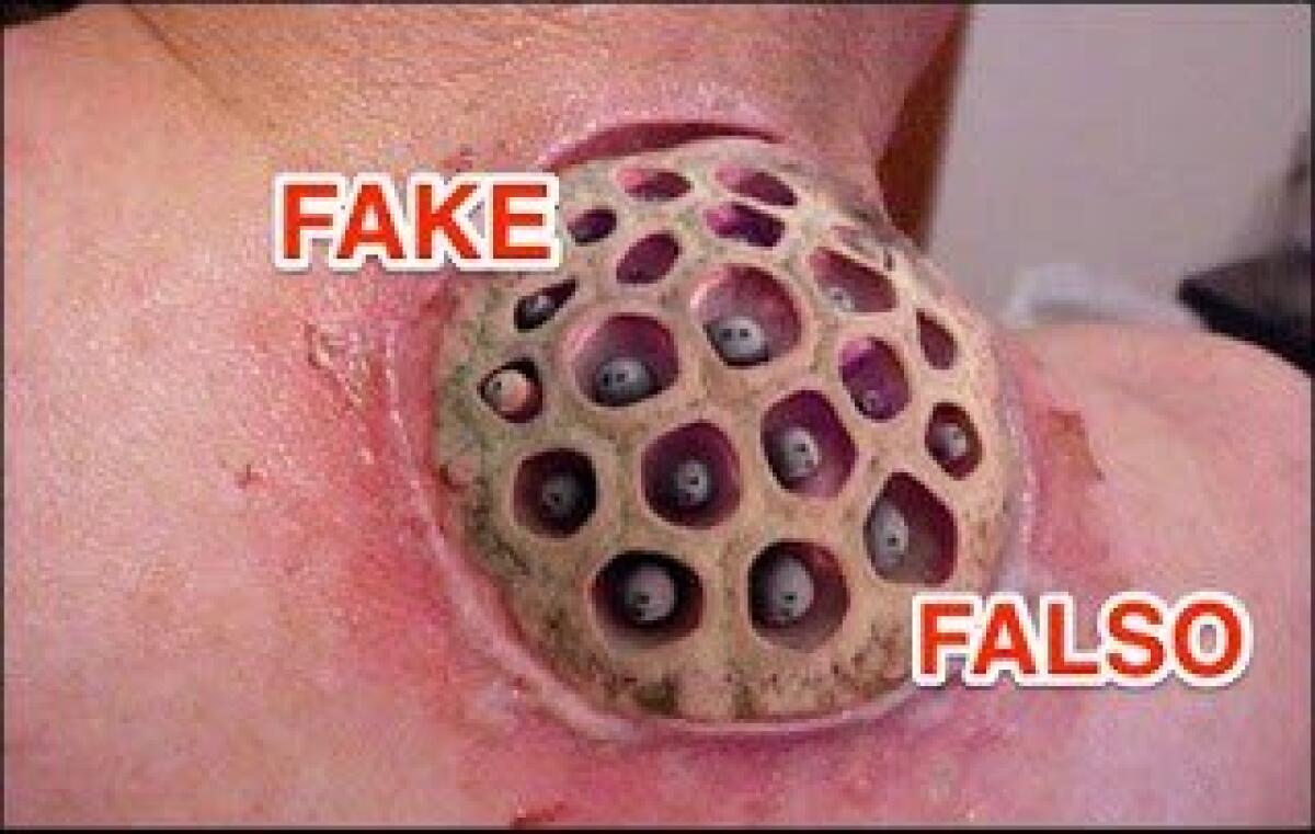 Impressionanti lesioni cutanee prodotte dallo shampoo è una bufala con virus! - 