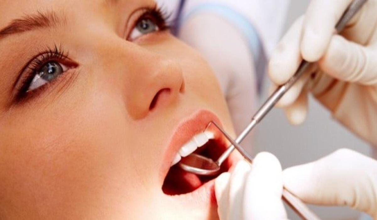 Addio alla carie ai denti grazie al nuovo smalto al fluoro - 