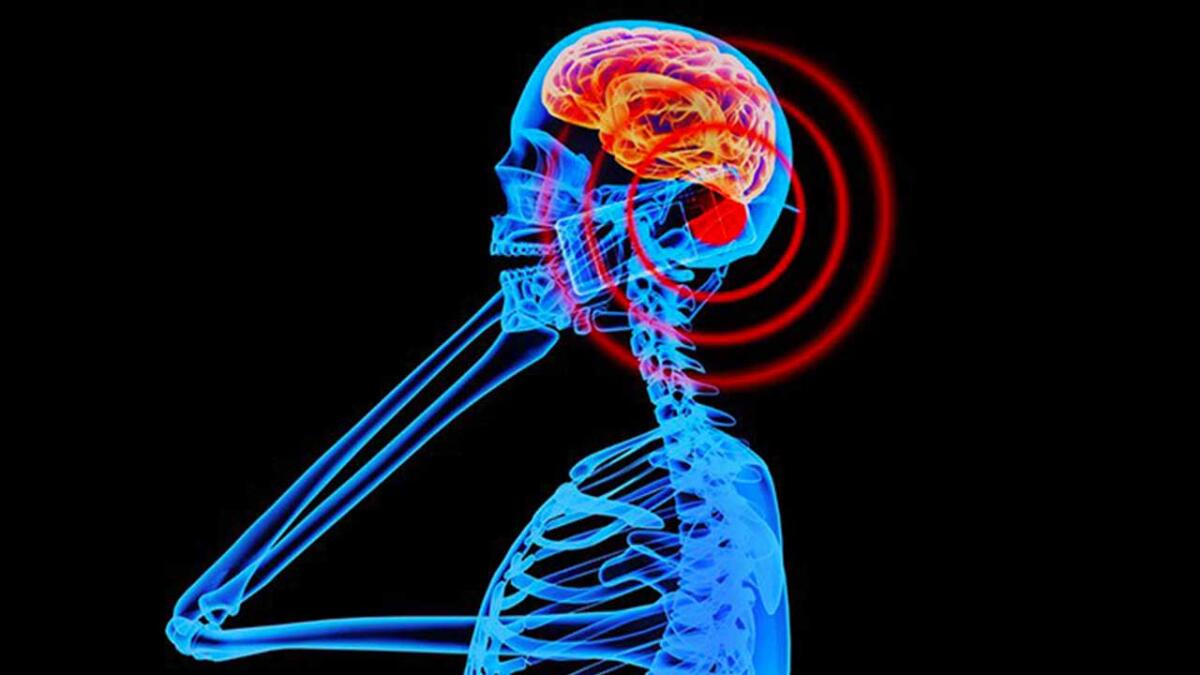 I 15 smartphone che emettono più radiazioni del 2018 - 